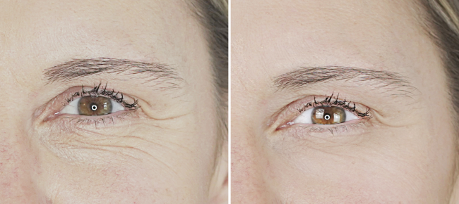 Voor na naast elkaar